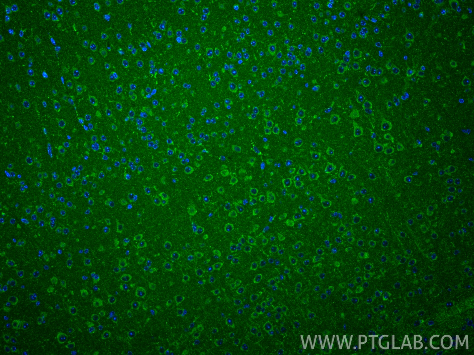 IF Staining of mouse brain using 24919-1-AP Immunofluorescence (IF) / fluorescent staining of mouse brain tissue using FAM82B Polyclonal antibody (24919-1-AP)