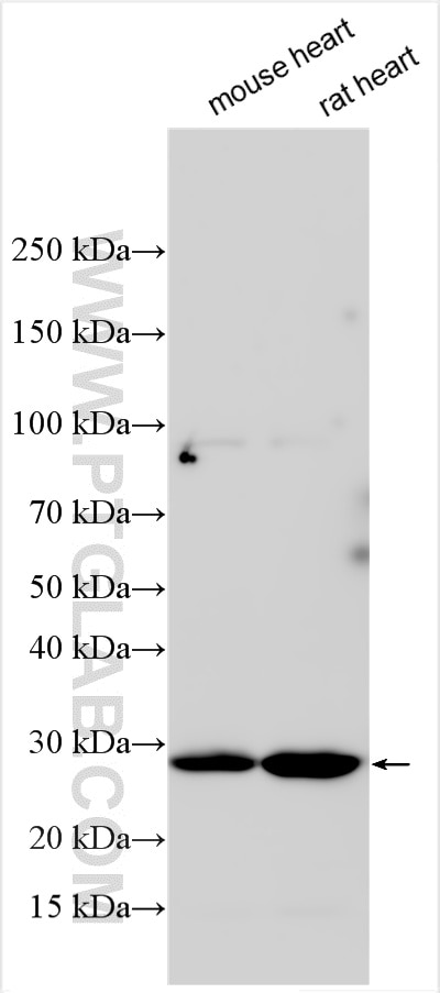 Western Blot (WB) analysis of various lysates using FAM82B Polyclonal antibody (24919-1-AP)