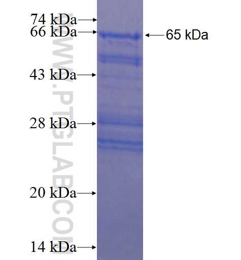 FAM83B fusion protein Ag22951 SDS-PAGE