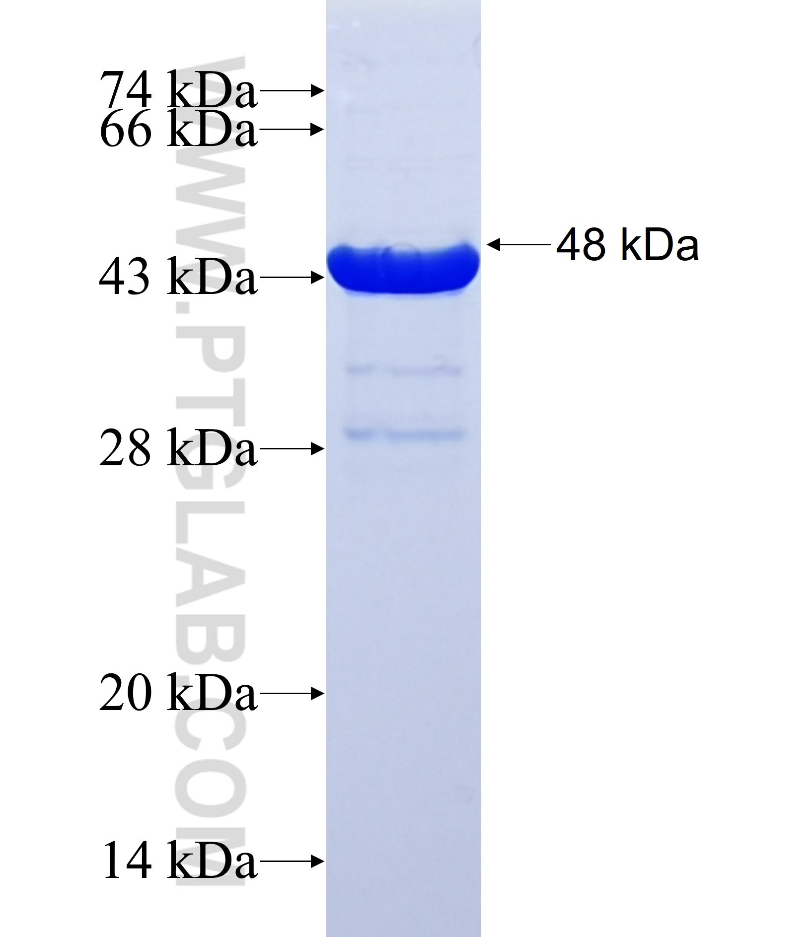 FAM83H fusion protein Ag37139 SDS-PAGE FAM83H fusion protein Ag37139 SDS-PAGE