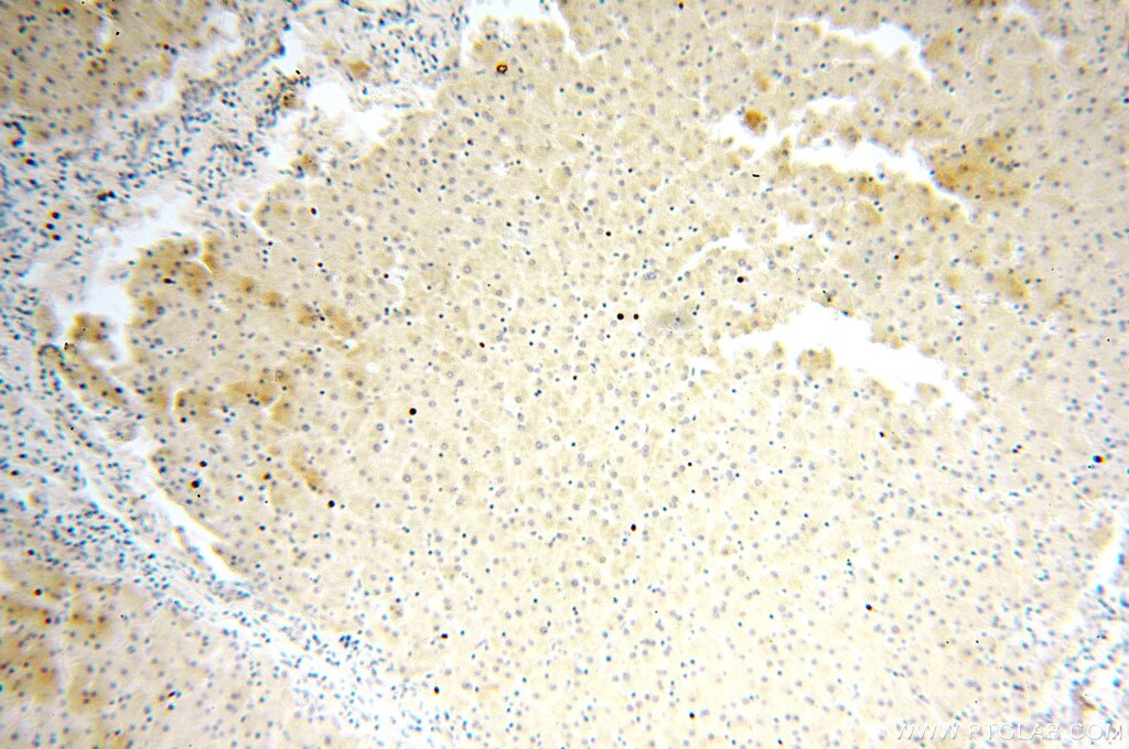 Immunohistochemistry (IHC) staining of human liver tissue using FAM84B Polyclonal antibody (18421-1-AP)