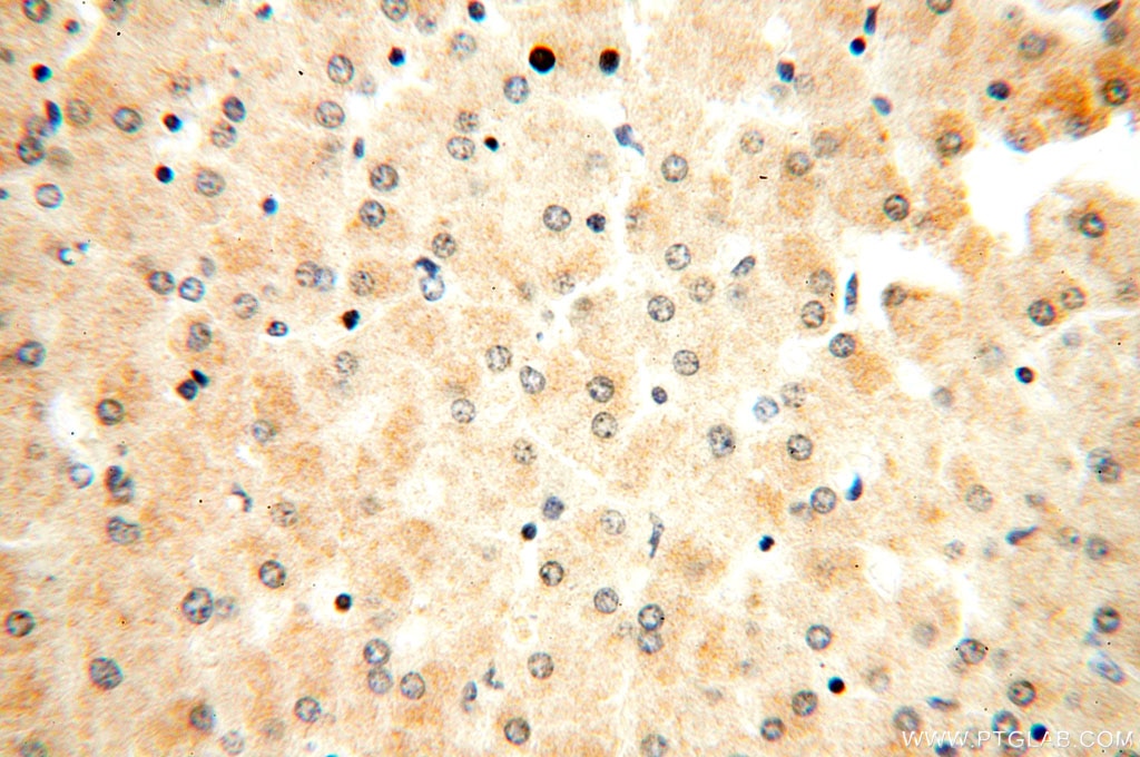 Immunohistochemistry (IHC) staining of human liver tissue using FAM84B Polyclonal antibody (18421-1-AP)