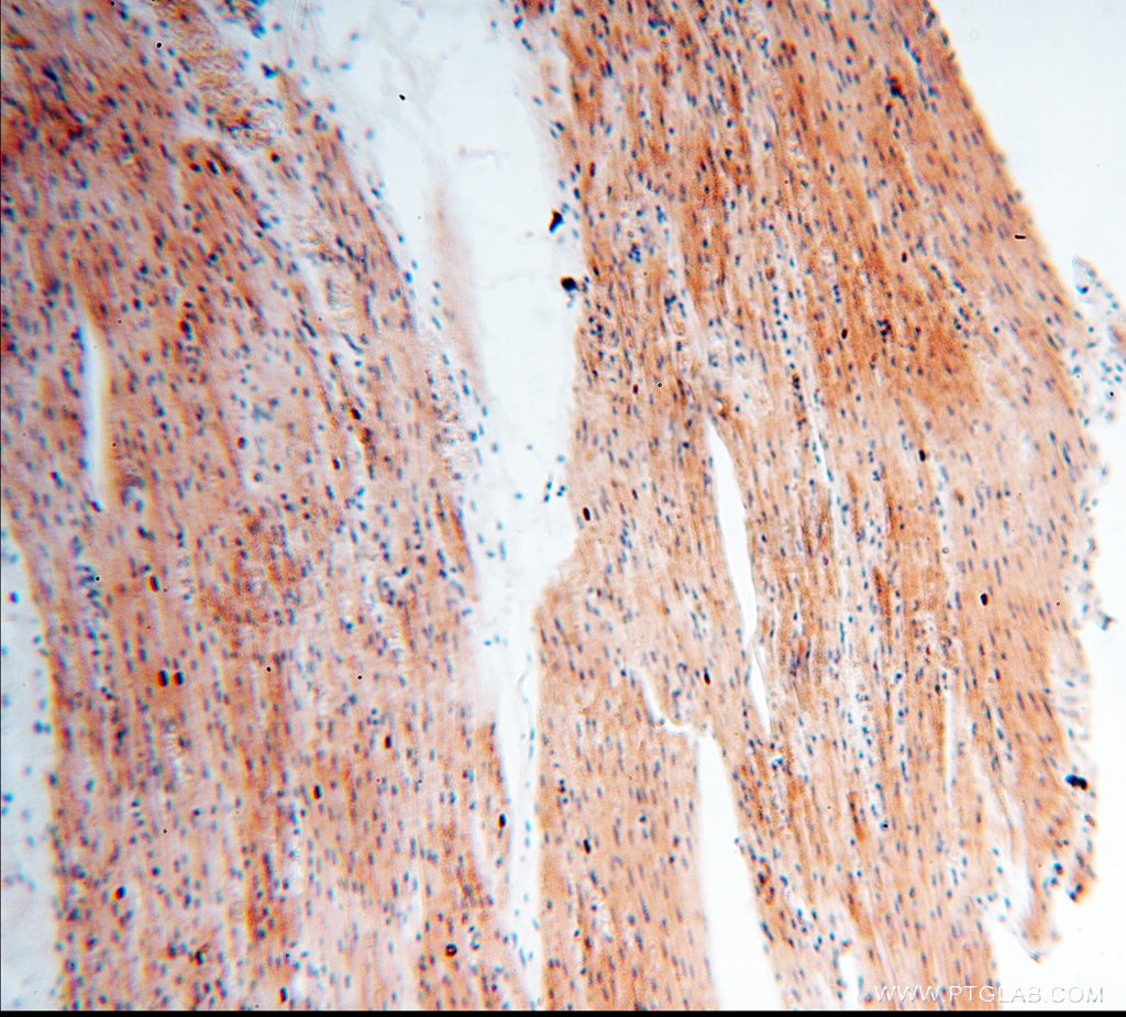 IHC staining of human heart using 18421-1-AP