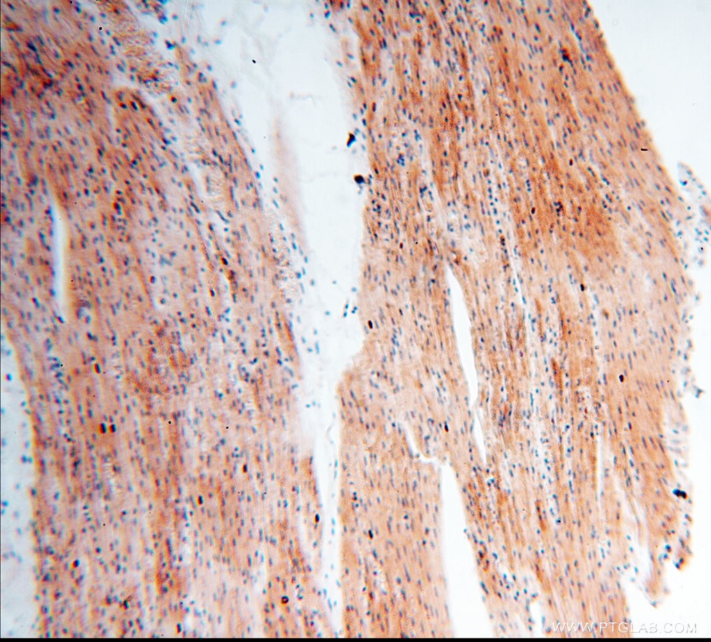 Immunohistochemistry (IHC) staining of human heart tissue using FAM84B Polyclonal antibody (18421-1-AP)