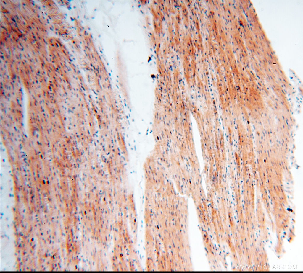 Immunohistochemistry (IHC) staining of human heart tissue using FAM84B Polyclonal antibody (18421-1-AP)