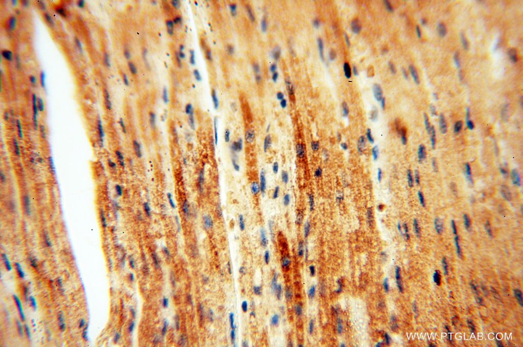 Immunohistochemistry (IHC) staining of human heart tissue using FAM84B Polyclonal antibody (18421-1-AP)