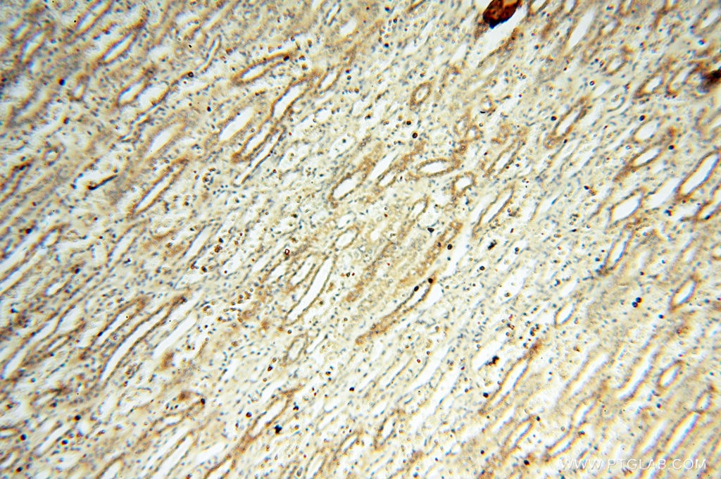 Immunohistochemistry (IHC) staining of human kidney tissue using FAM84B Polyclonal antibody (18421-1-AP)