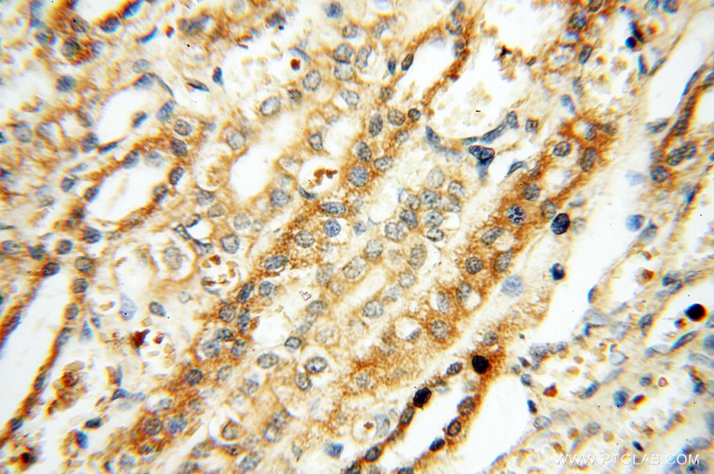 Immunohistochemistry (IHC) staining of human kidney tissue using FAM84B Polyclonal antibody (18421-1-AP)