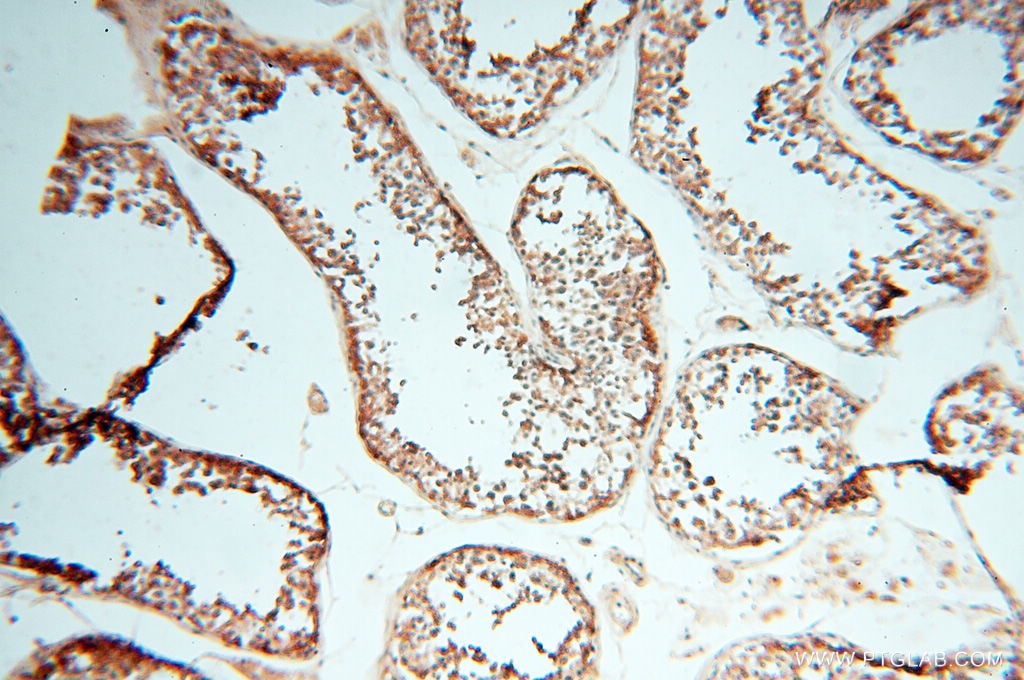 Immunohistochemistry (IHC) staining of human testis tissue using FAM84B Polyclonal antibody (18421-1-AP)
