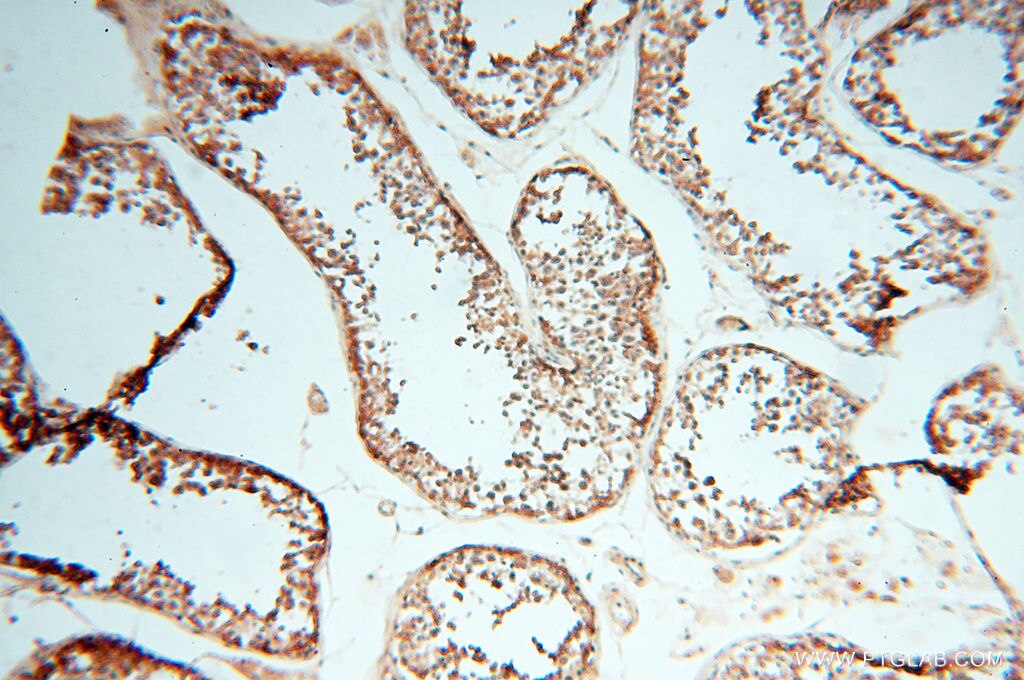 IHC staining of human testis using 18421-1-AP