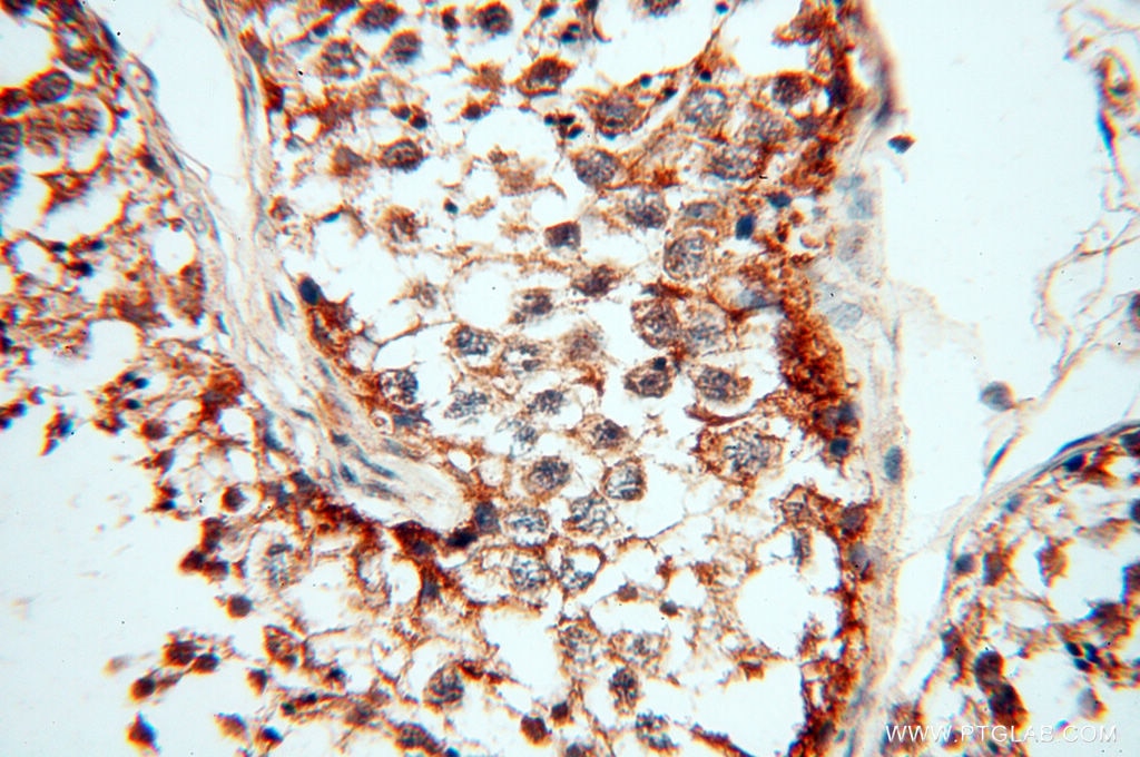 Immunohistochemistry (IHC) staining of human testis tissue using FAM84B Polyclonal antibody (18421-1-AP)