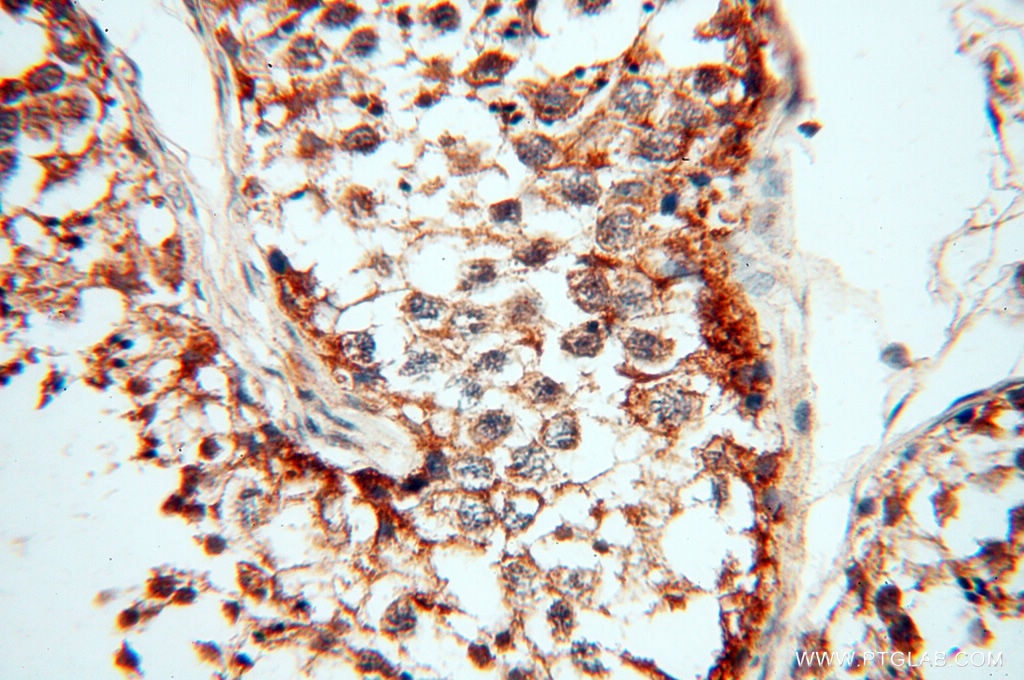 IHC staining of human testis using 18421-1-AP