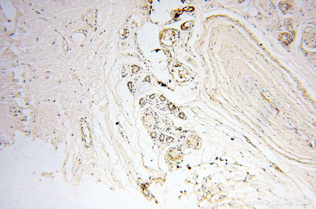 Immunohistochemistry (IHC) staining of human skin tissue using FAM84B Polyclonal antibody (18421-1-AP)