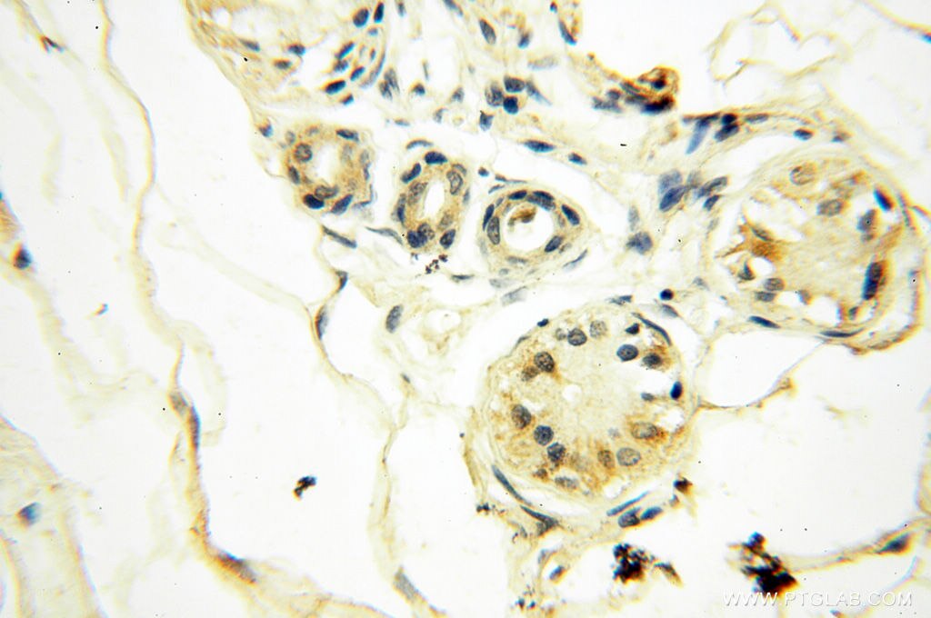 Immunohistochemistry (IHC) staining of human skin tissue using FAM84B Polyclonal antibody (18421-1-AP)