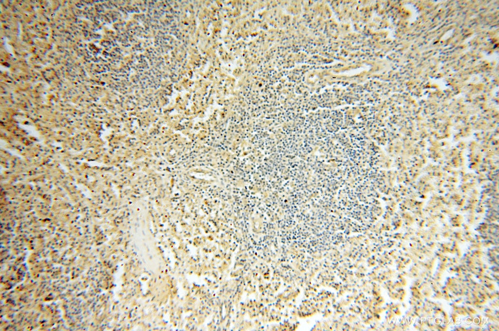 Immunohistochemistry (IHC) staining of human spleen tissue using FAM84B Polyclonal antibody (18421-1-AP)