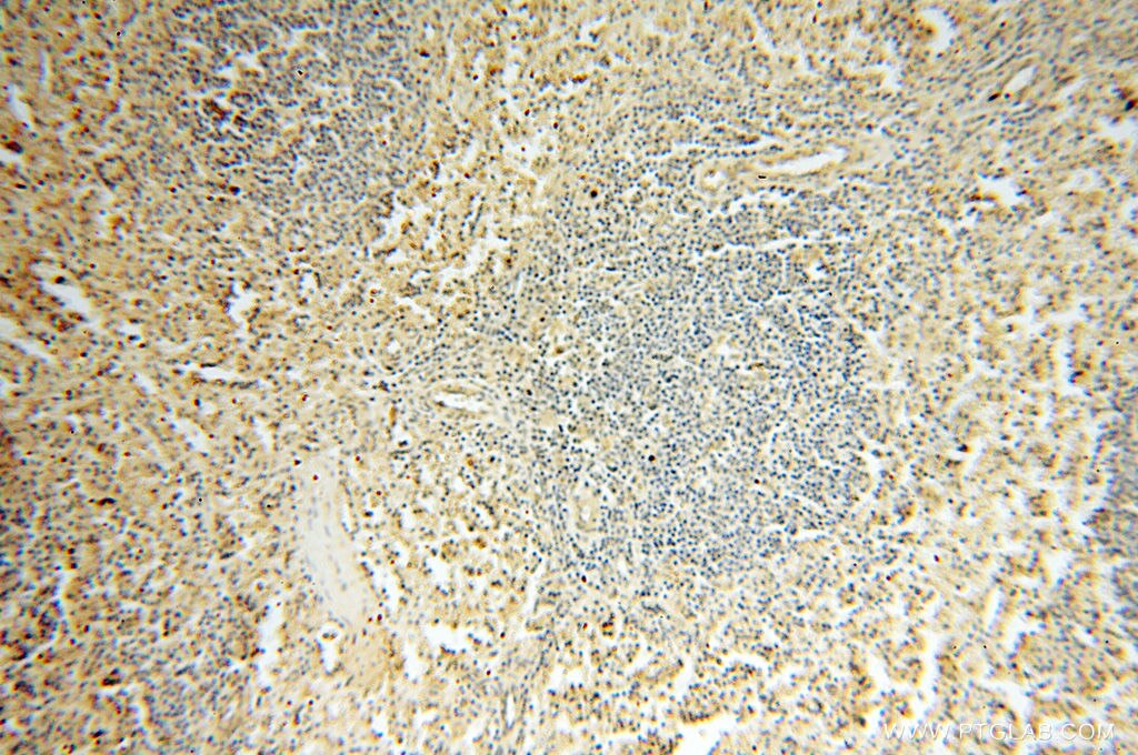 IHC staining of human spleen using 18421-1-AP