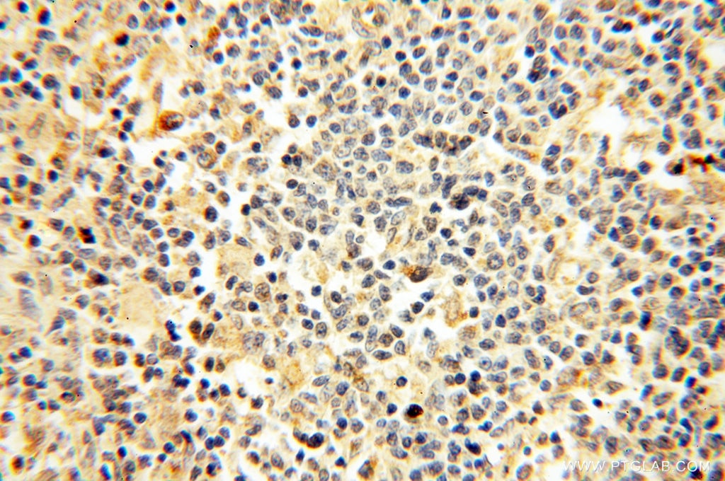 Immunohistochemistry (IHC) staining of human spleen tissue using FAM84B Polyclonal antibody (18421-1-AP)