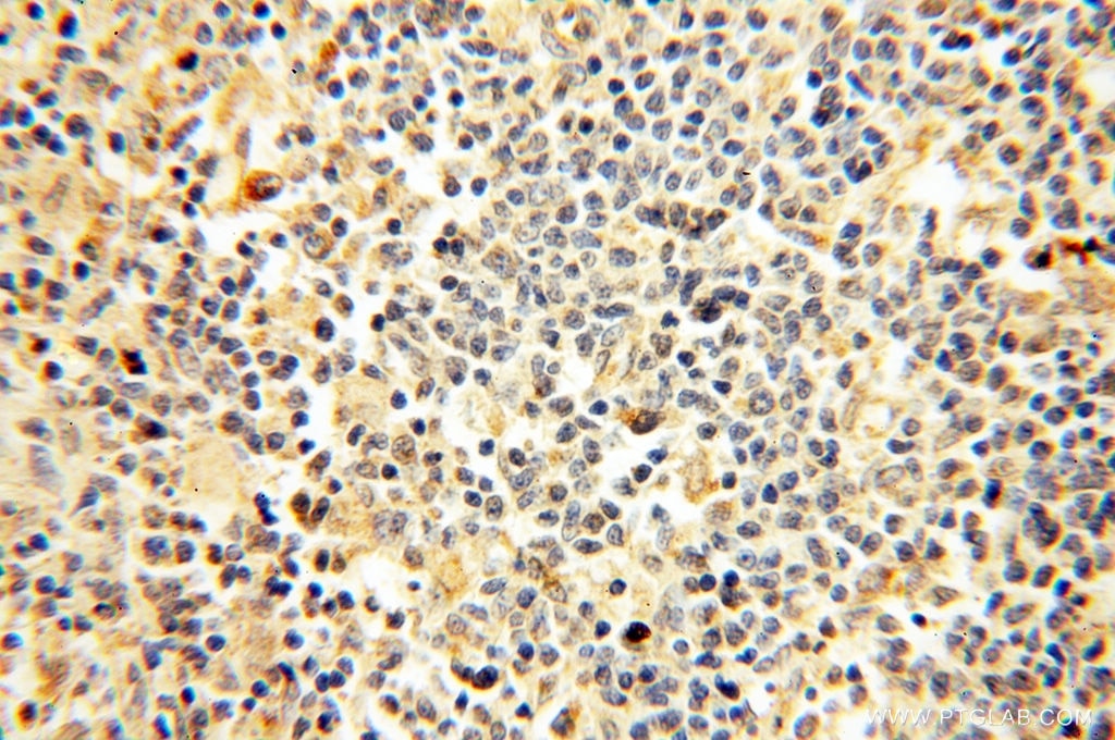 IHC staining of human spleen using 18421-1-AP