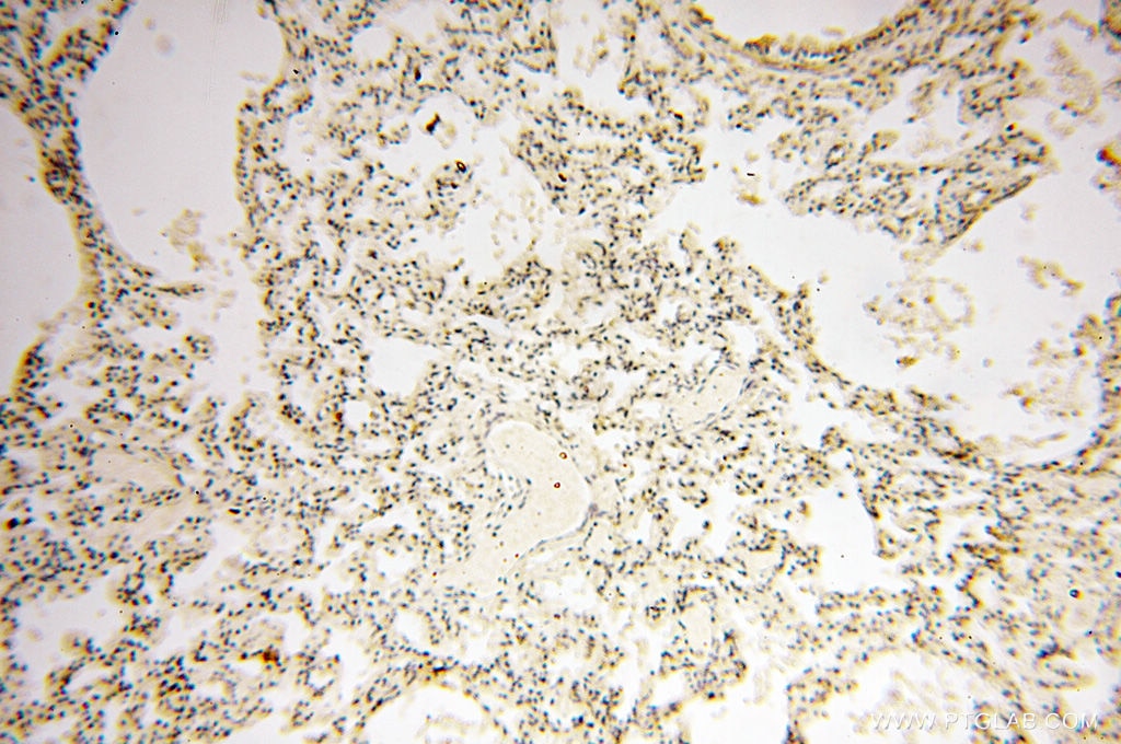 Immunohistochemistry (IHC) staining of human lung tissue using FAM84B Polyclonal antibody (18421-1-AP)
