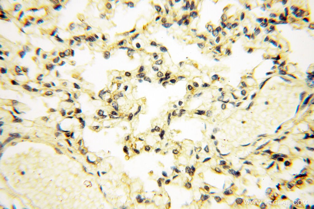 Immunohistochemistry (IHC) staining of human lung tissue using FAM84B Polyclonal antibody (18421-1-AP)