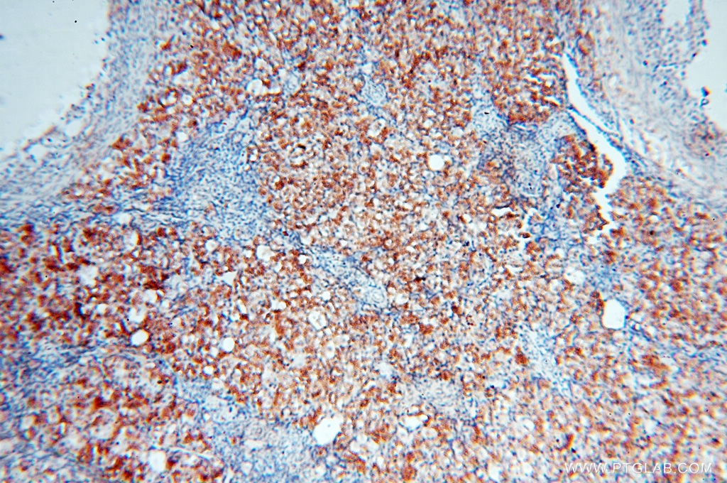 Immunohistochemistry (IHC) staining of human ovary tissue using FAM84B Polyclonal antibody (18421-1-AP)