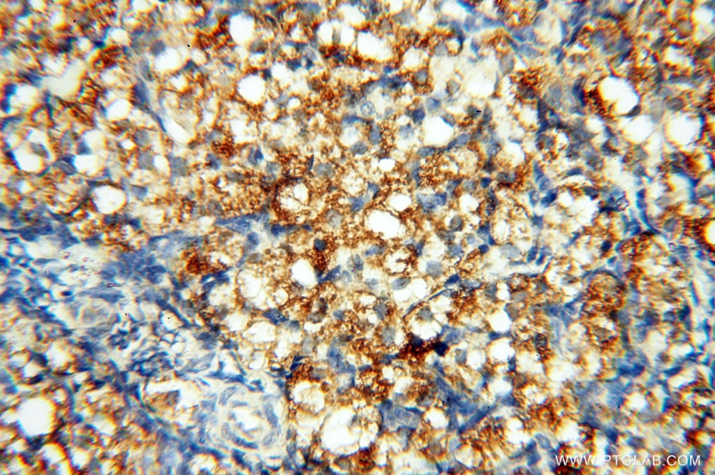 Immunohistochemistry (IHC) staining of human ovary tissue using FAM84B Polyclonal antibody (18421-1-AP)