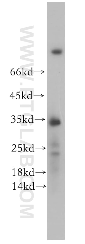 Western Blot (WB) analysis of Jurkat cells using FAM84B Polyclonal antibody (18421-1-AP)