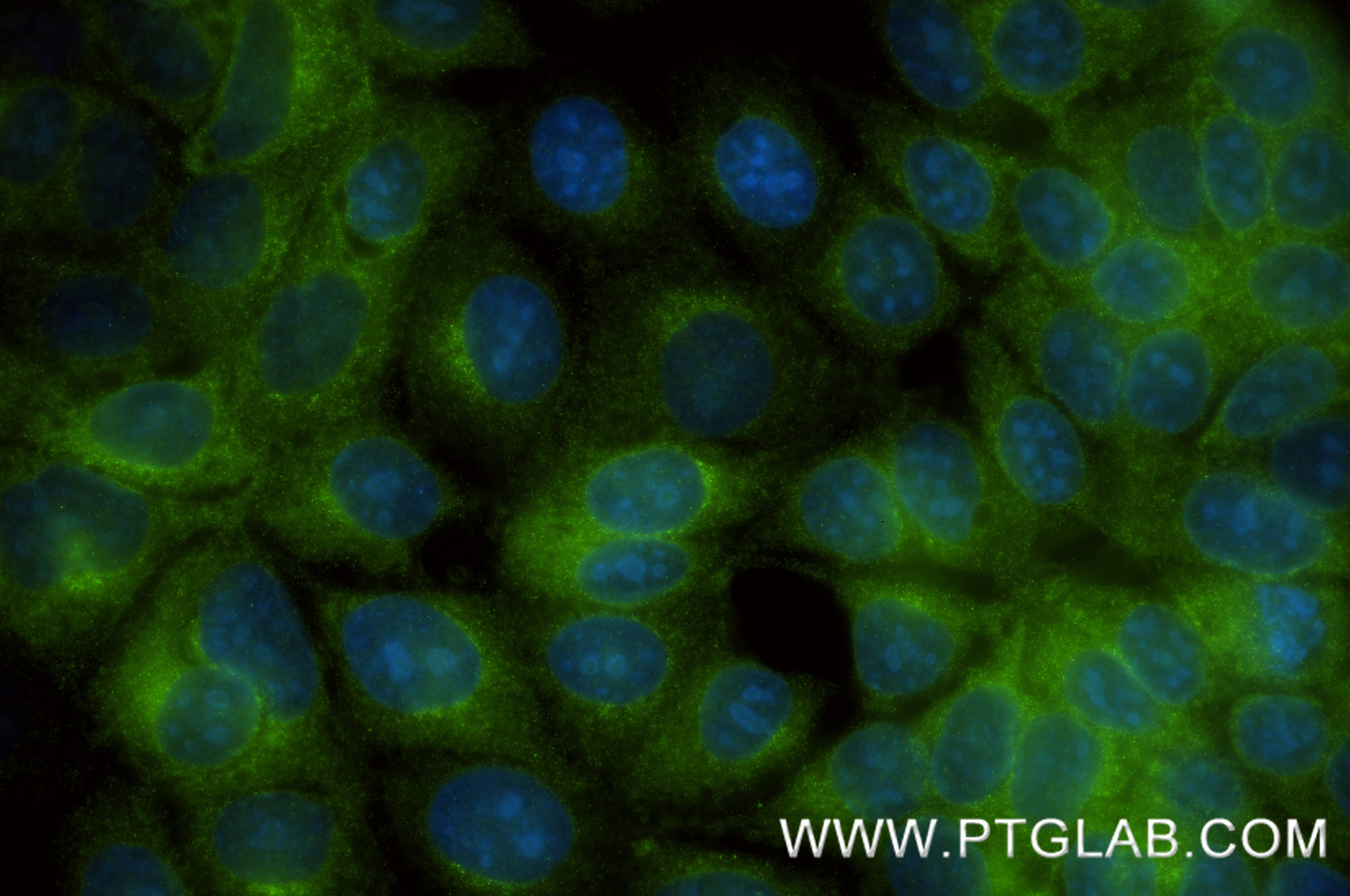 Immunofluorescence (IF) / fluorescent staining of MCF-7 cells using FAM84B Recombinant monoclonal antibody (87176-3-RR)