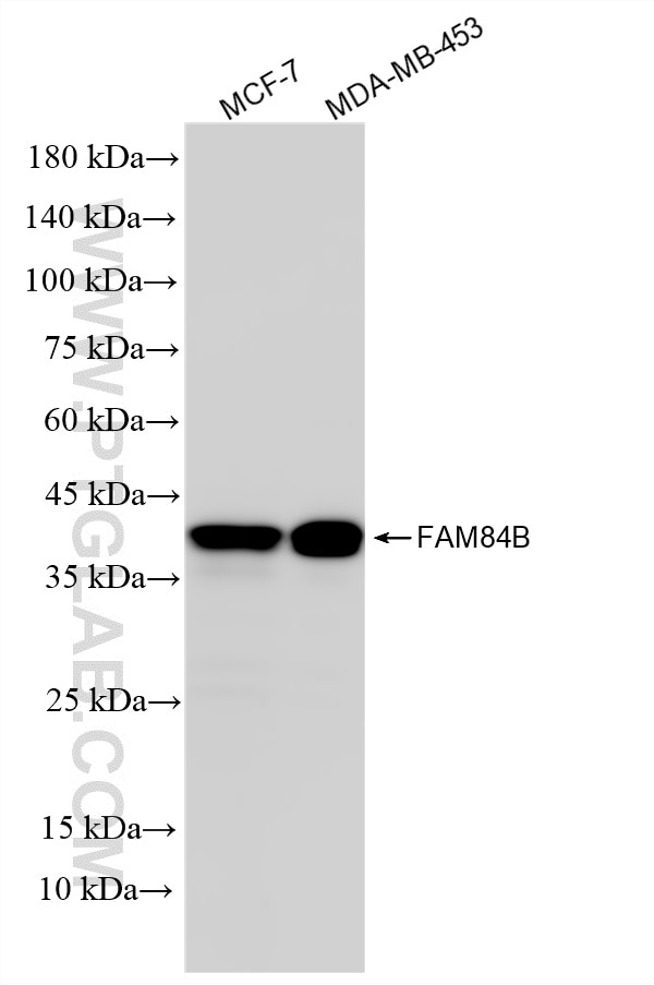 Western Blot (WB) analysis of various lysates using FAM84B Recombinant monoclonal antibody (87176-3-RR)