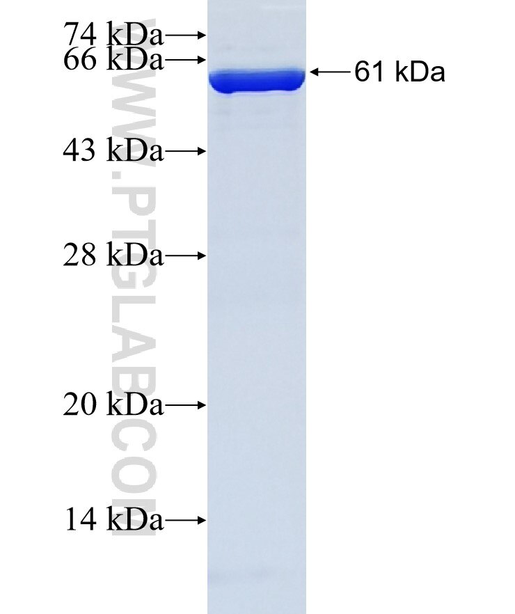 FAM86A fusion protein Ag38481 SDS-PAGE