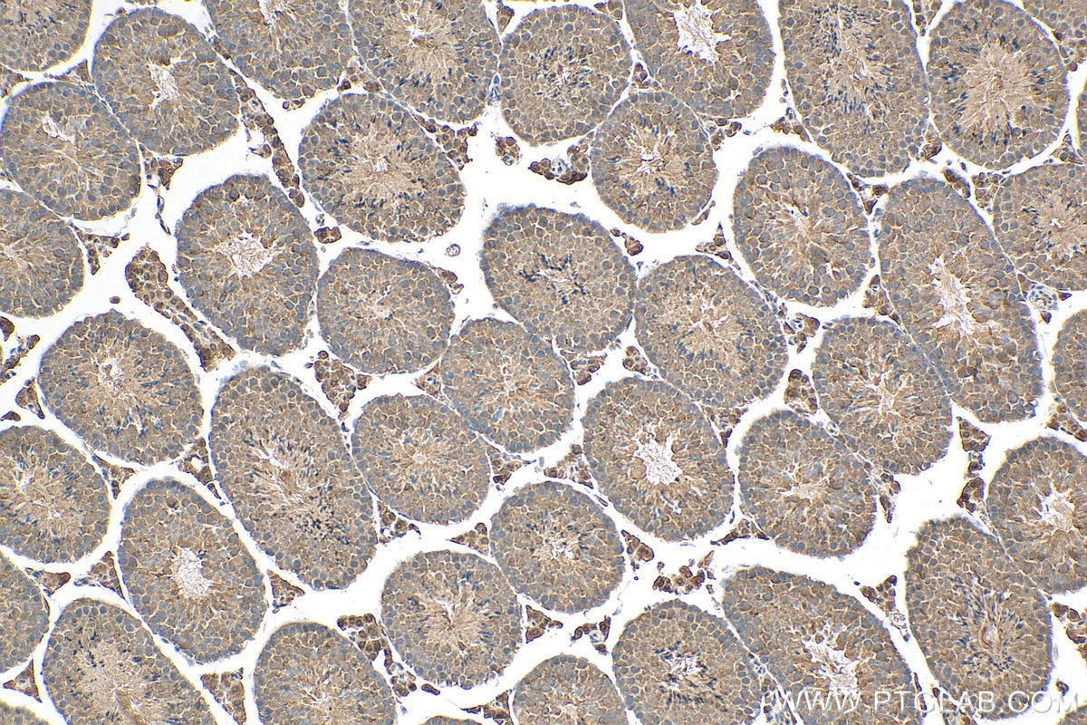 Immunohistochemistry (IHC) staining of mouse testis tissue using FAM8A1 Polyclonal antibody (24746-1-AP)