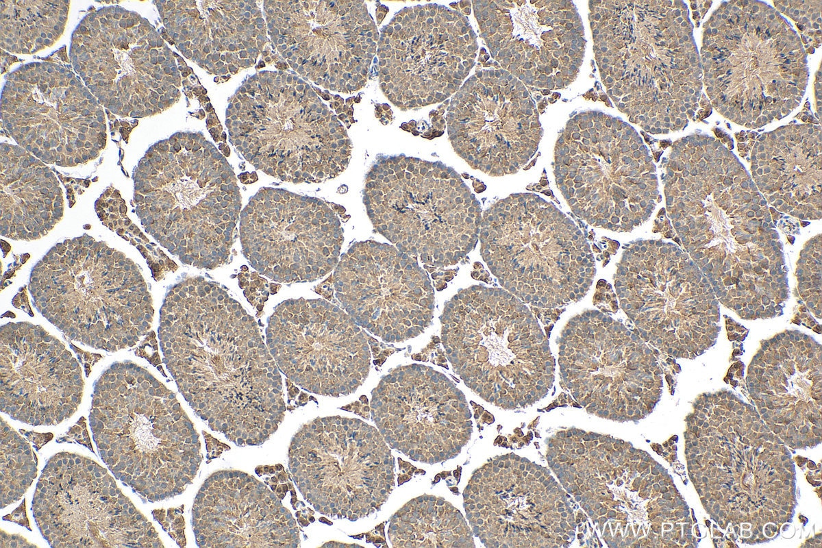 IHC staining of mouse testis using 24746-1-AP