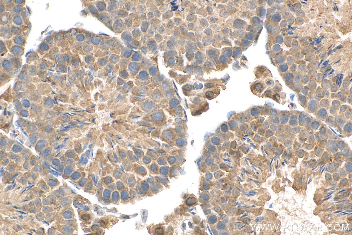 IHC staining of mouse testis using 24746-1-AP