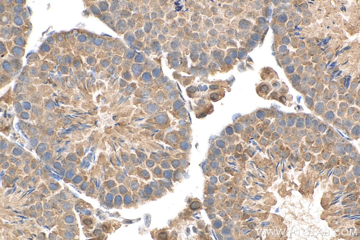 Immunohistochemistry (IHC) staining of mouse testis tissue using FAM8A1 Polyclonal antibody (24746-1-AP)