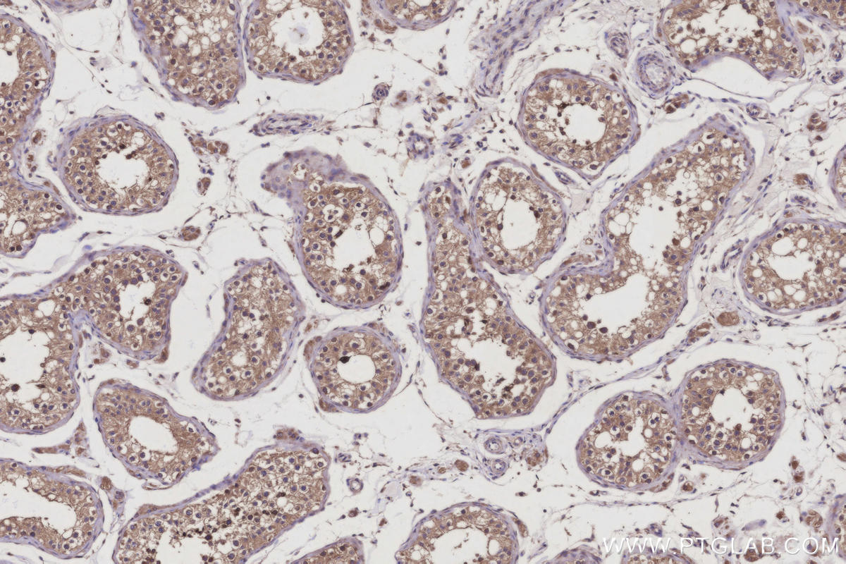 Immunohistochemistry (IHC) staining of human testis tissue using FAM8A1 Polyclonal antibody (24746-1-AP)