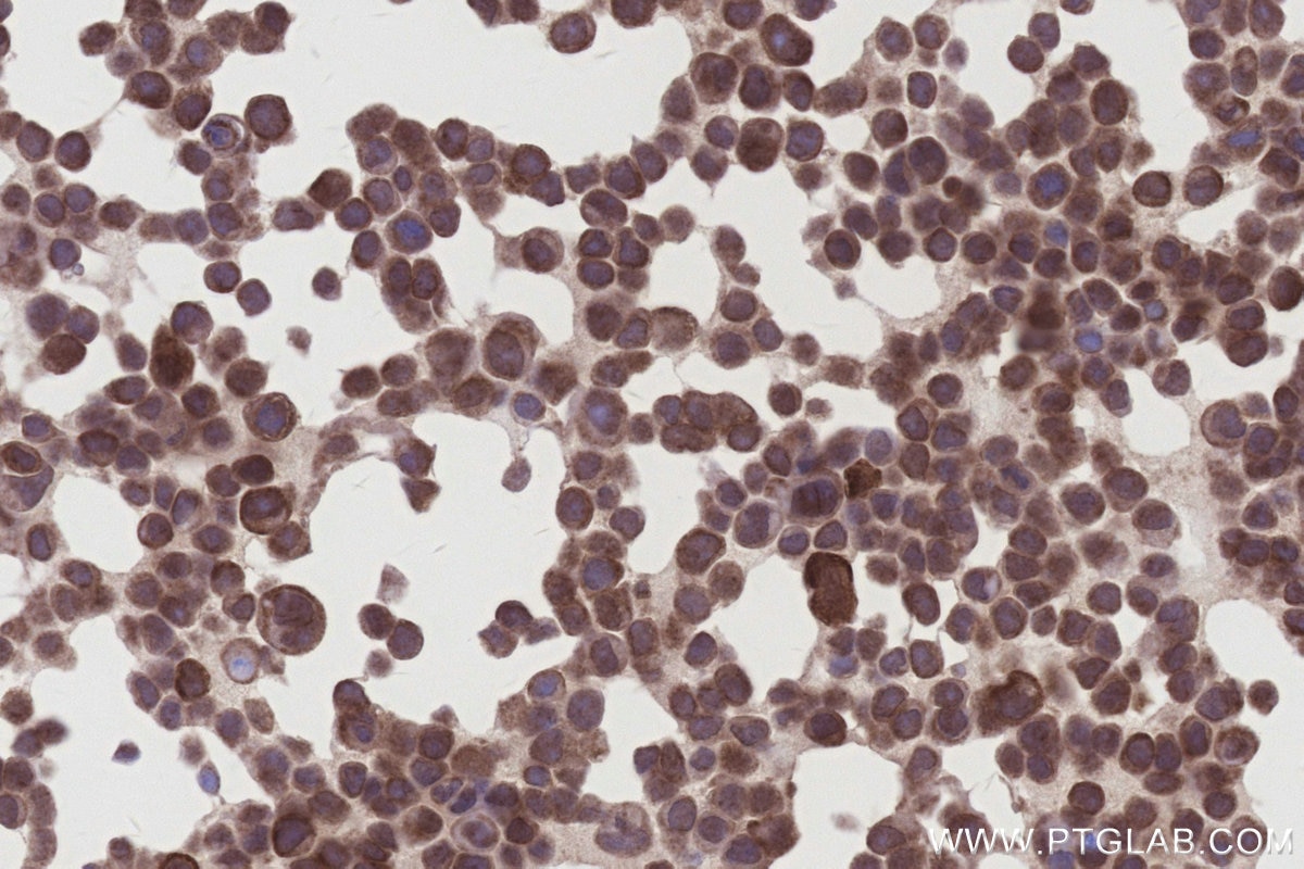 Immunohistochemistry (IHC) staining of MCF-7 cells using FAM8A1 Polyclonal antibody (24746-1-AP)