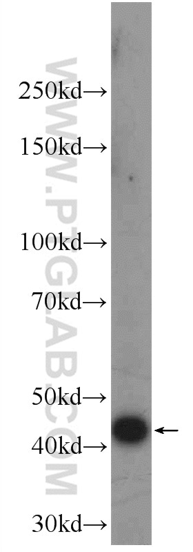 Western Blot (WB) analysis of HEK-293 cells using FAM8A1 Polyclonal antibody (24746-1-AP)