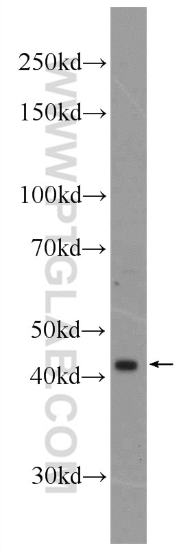 Western Blot (WB) analysis of mouse kidney tissue using FAM8A1 Polyclonal antibody (24746-1-AP)