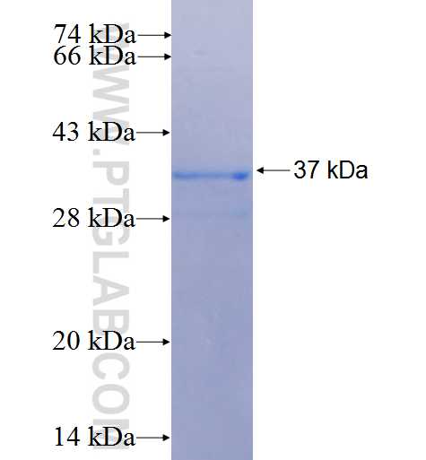 FAM91A1 fusion protein Ag26902 SDS-PAGE