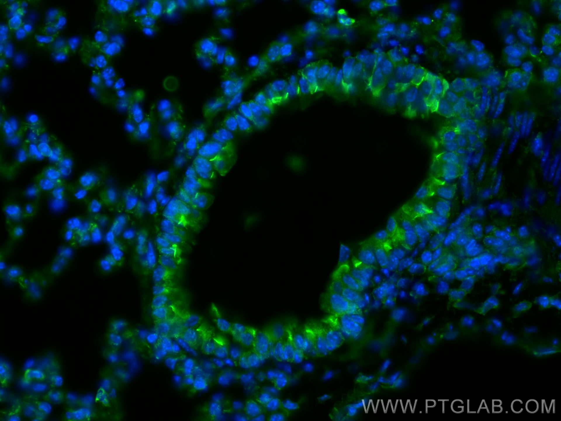IF Staining of mouse lung using 26413-1-AP