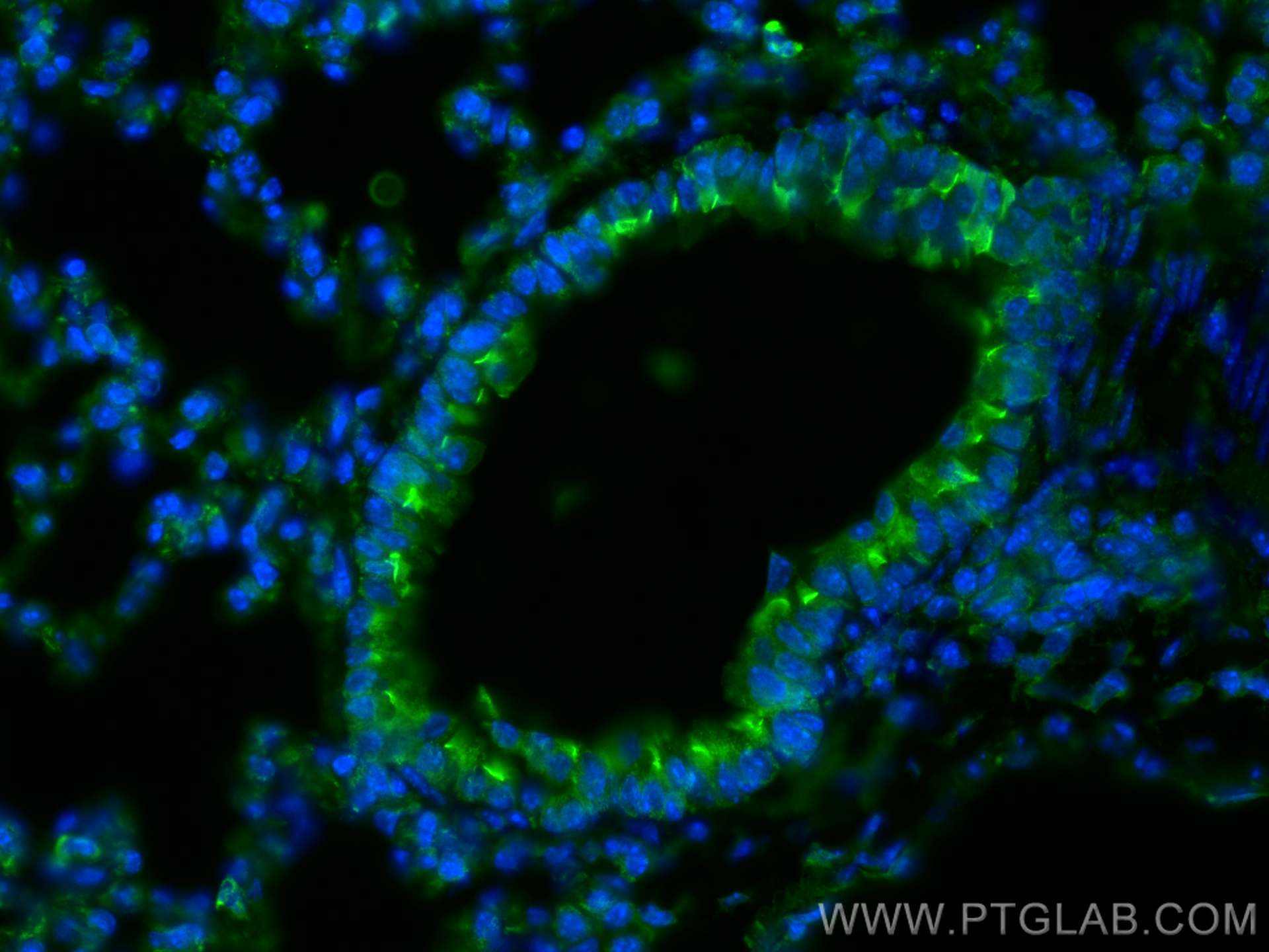 Immunofluorescence (IF) / fluorescent staining of mouse lung tissue using FAM92B/CIBAR2 Polyclonal antibody (26413-1-AP)
