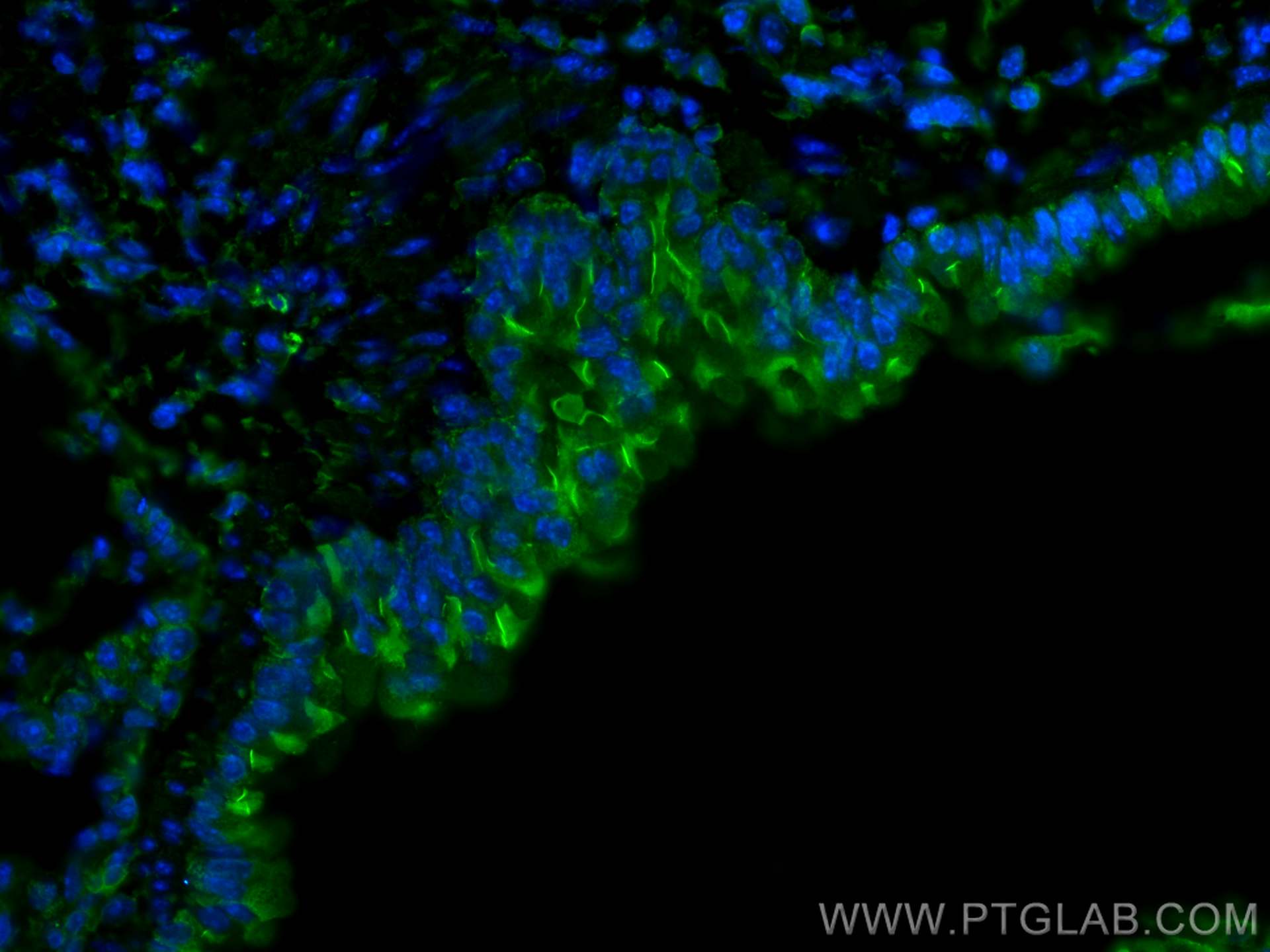 Immunofluorescence (IF) / fluorescent staining of mouse lung tissue using FAM92B/CIBAR2 Polyclonal antibody (26413-1-AP)