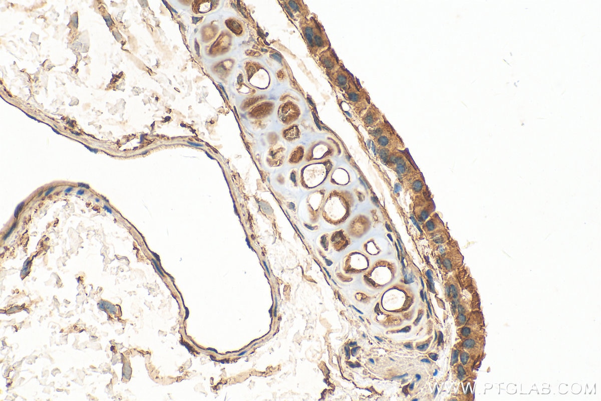 Immunohistochemistry (IHC) staining of mouse lung tissue using FAM92B/CIBAR2 Polyclonal antibody (26413-1-AP)