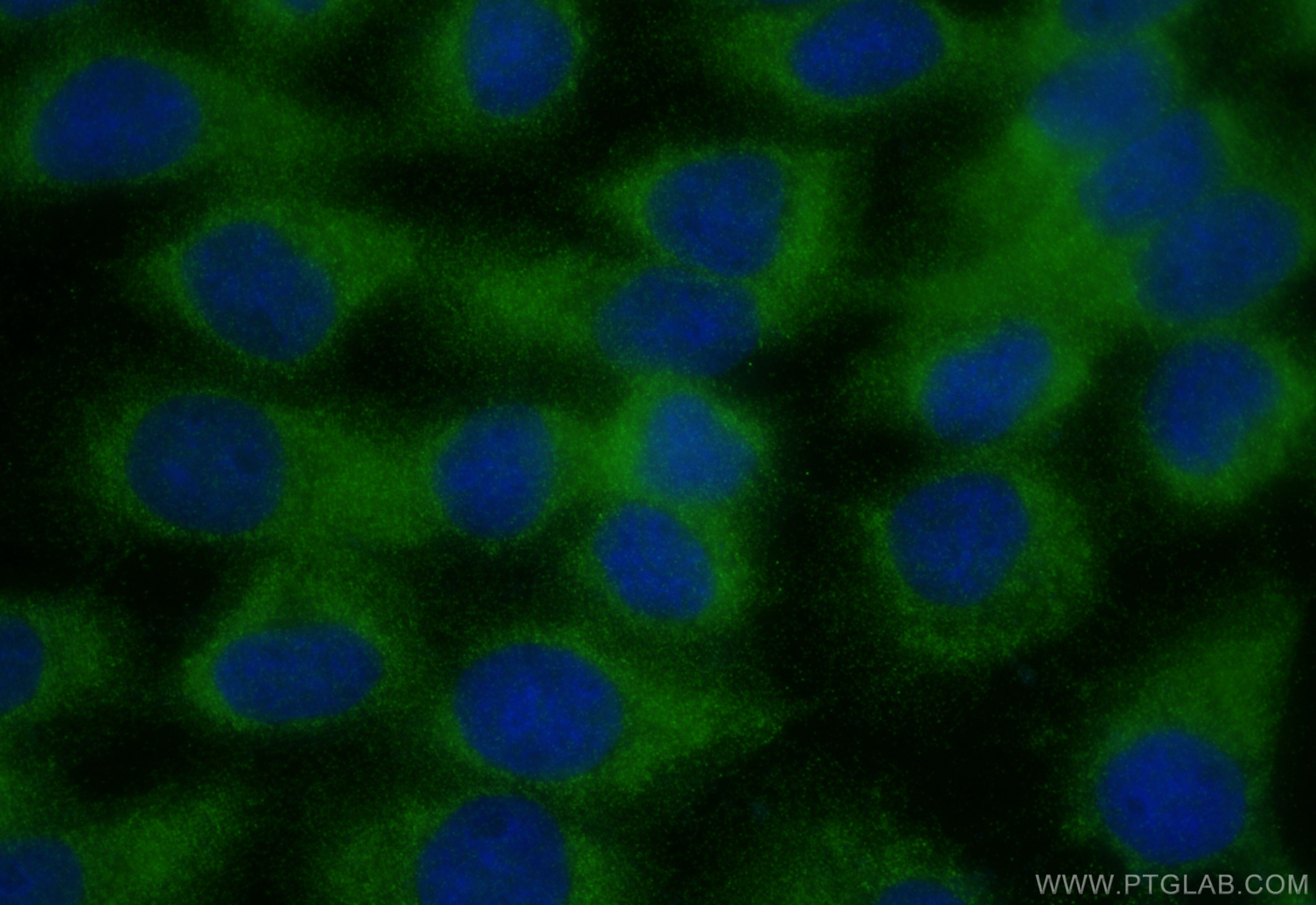 Immunofluorescence (IF) / fluorescent staining of A431 cells using FAM96A Polyclonal antibody (20776-1-AP)