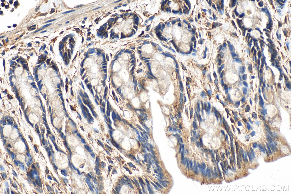 Immunohistochemistry (IHC) staining of rat colon tissue using FAM96A Polyclonal antibody (20776-1-AP)