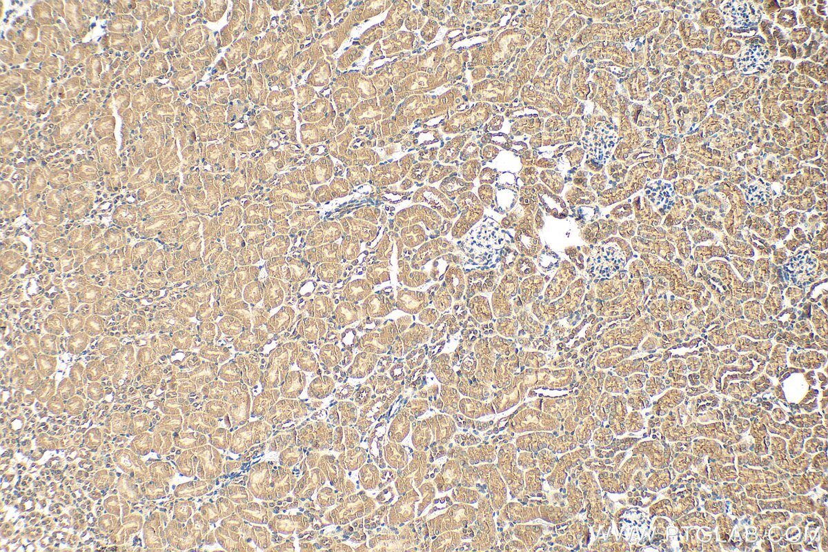 Immunohistochemistry (IHC) staining of mouse kidney tissue using FAM96B Polyclonal antibody (20108-1-AP)