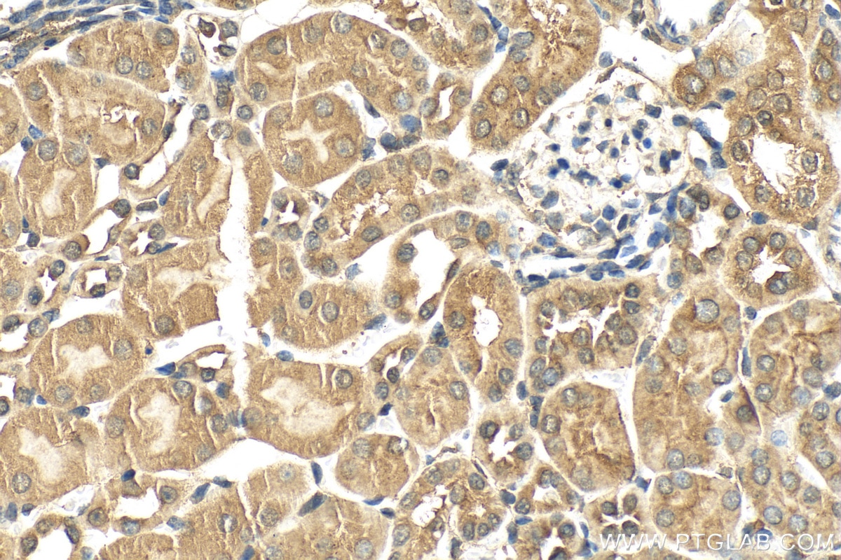 Immunohistochemistry (IHC) staining of mouse kidney tissue using FAM96B Polyclonal antibody (20108-1-AP)