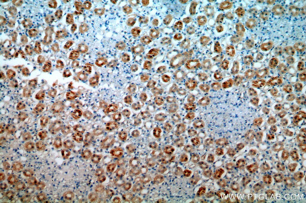 IHC staining of human kidney using 20108-1-AP