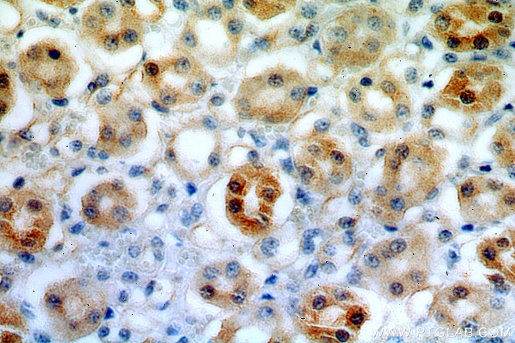IHC staining of human kidney using 20108-1-AP