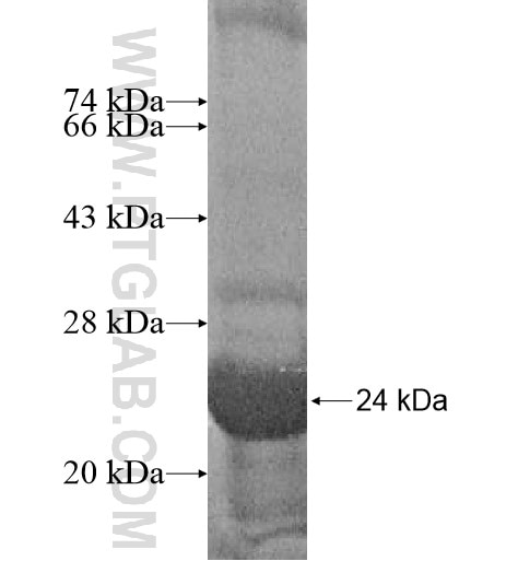 FAM96B fusion protein Ag14483 SDS-PAGE